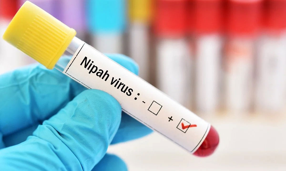 Nipah Virus Scare Returns in Kerala: Two Dead, over 380 Under Surveillance 1 Nipah Virus Scare Returns in Kerala: Two Dead, over 380 Under Surveillance