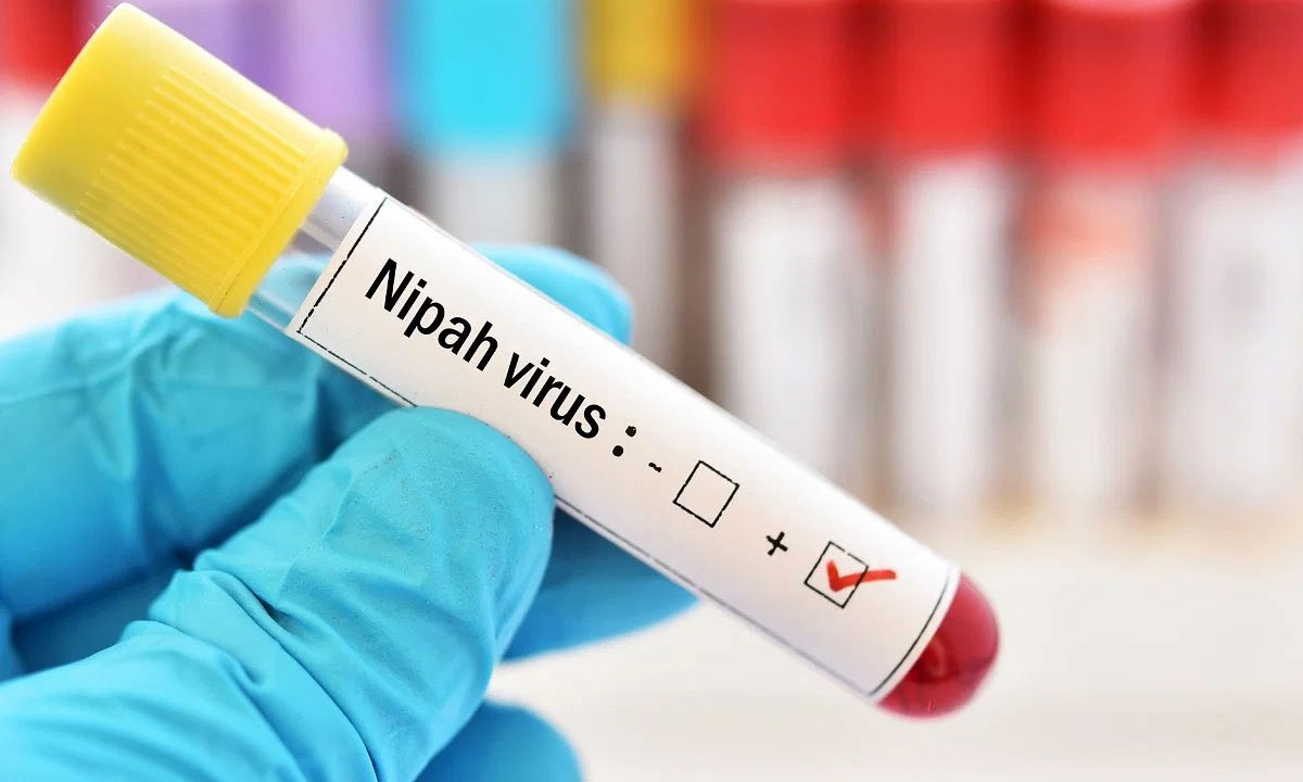 Kerala on Alert After Second Suspected Nipah Fatality; Health Teams Intensify Efforts 1 Kerala on Alert After Second Suspected Nipah Fatality; Health Teams Intensify Efforts