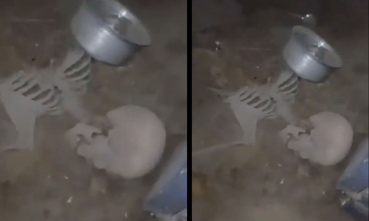 Nampally Human Skeleton Mystery Solved: Nokia Phone with 84 Missed Calls Unravels Identity 1 Nampally Human Skeleton Mystery Solved: Nokia Phone with 84 Missed Calls Unravels Identity