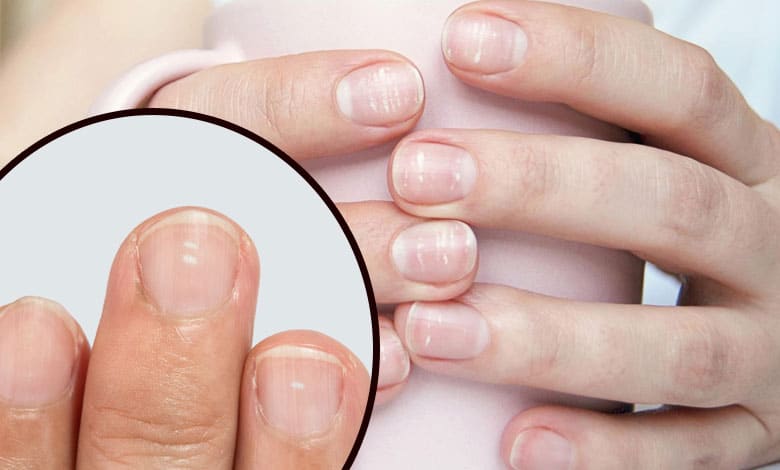 NAIL CHAINGER Spotting Cancer Early: These 10 Symptoms Could Save Your Life! in Both Men and Women