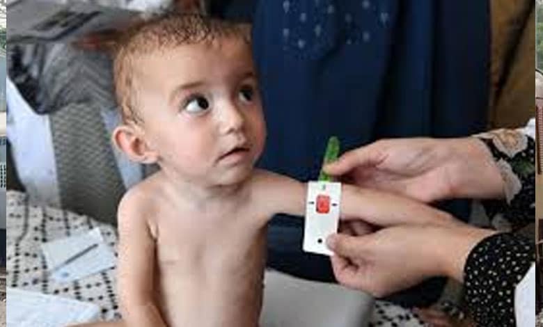 Afghan children with heart disease receive free treatment