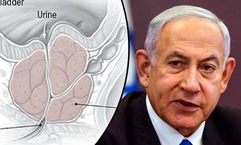 NETANYAHU 7 Netanyahu Undergoes Prostate Surgery Amid Regional and Domestic Crises