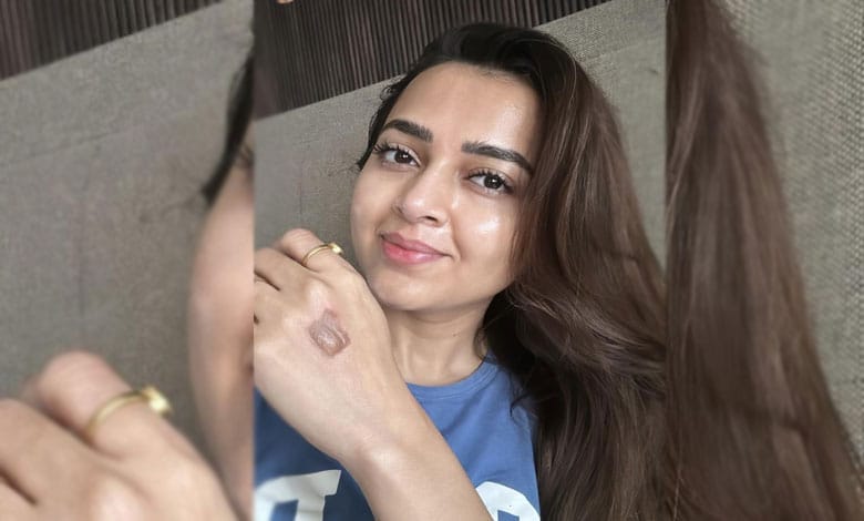 Tejasswi Prakash Suffers Burn Injury on the Sets of “Celebrity MasterChef,”