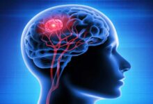 Study Finds Men 3x More Likely to Die from Traumatic Brain Injury