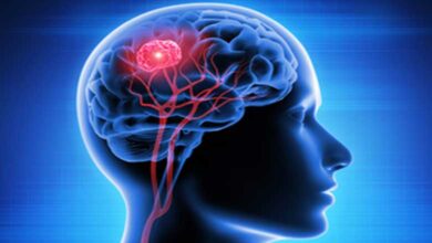 Study Finds Men 3x More Likely to Die from Traumatic Brain Injury