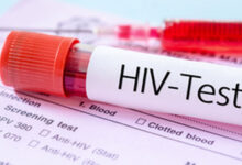 Global HIV Prevalence Diagnosed Cases to Reach 2.2 million by 2033, Report Reveals