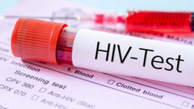 Global HIV Prevalence Diagnosed Cases to Reach 2.2 million by 2033, Report Reveals