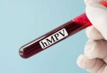 Two Children Test Positive for HMPV in Nagpur: No Surge in Respiratory Illnesses, Says Centre