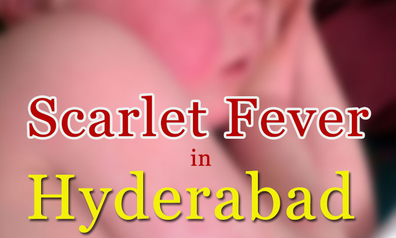 SCAELET FEVER 1 Hyderabad's Surge in Scarlet Fever Cases: How to Protect Your Child This Winter