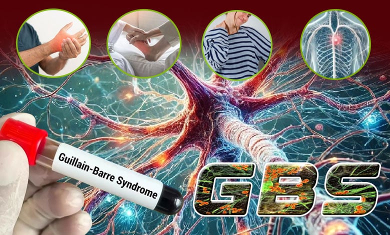 GBS VIRUS 1 1 From Muscle Weakness to Heart and Respiratory Risks, Understanding Guillain–Barré Syndrome: A Life-Threatening Neurological Disorder