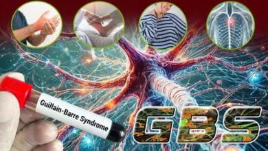 From Muscle Weakness to Heart and Respiratory Risks, Understanding Guillain–Barré Syndrome: A Life-Threatening Neurological Disorder