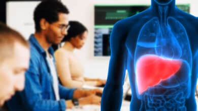 Health Crisis: 84% of Hyderabad IT Employees Suffer from Fatty Liver, Bengaluru Sounds Alarm