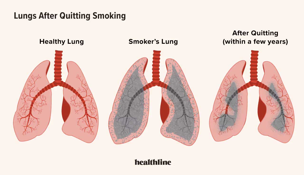 4 1 Stop Smoking Now and See Amazing Changes in 72 Hours – Here’s What You Need to Know