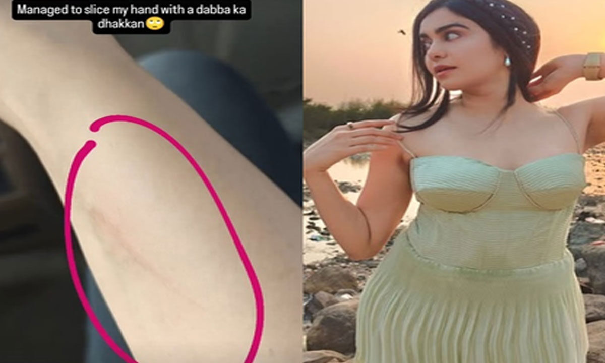 Adah Sharma Hilariously ‘Sliced’ Her Hand with ‘Dabba Ka Dhakkan’