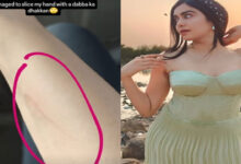 Adah Sharma Hilariously ‘Sliced’ Her Hand with ‘Dabba Ka Dhakkan’