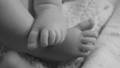 Hyderabad Shocker: Toddler Succumbs to Severe Burns from Hot Water Bucket
