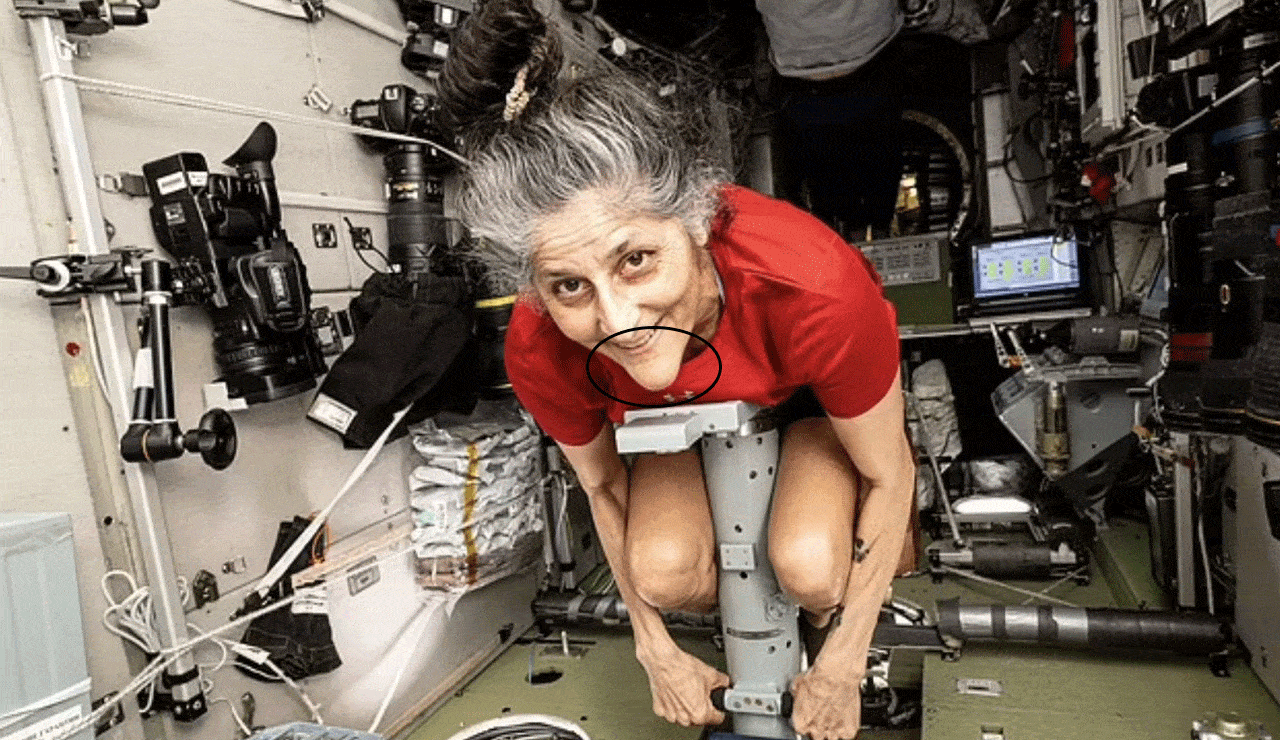 Sunita Williams' Physical Changes After 9 Months in Space: What Experts Say