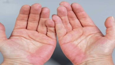 Fatty Liver Disease: 5 Early Warning Signs That Show Up on Your Hands