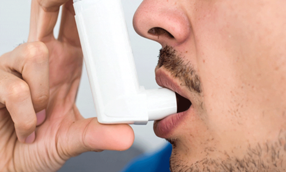 Inflammatory cells remain in the blood even after treatment of severe asthma: a study