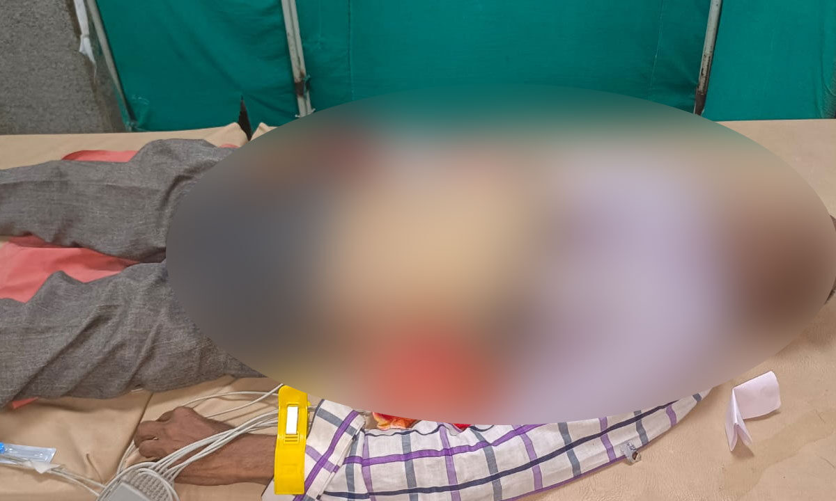 Hyderabad: Nampally Fish Prasadam Event Elderly Man Dies While Waiting in Queue