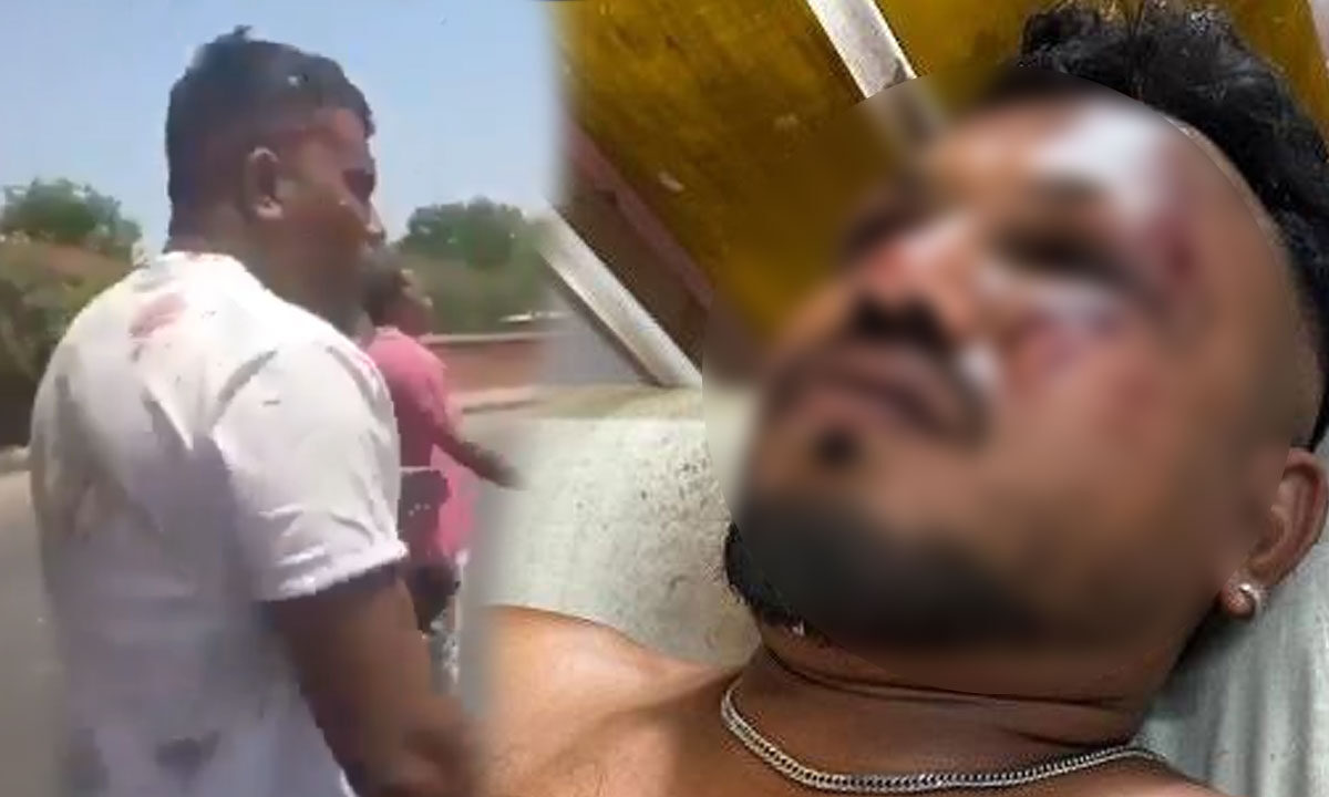 Ahmedabad Plane Crash Survivor Vishwas Recounts Terrifying Ordeal: “I Woke Up Surrounded by Dead Bodies and...”