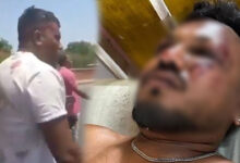 Ahmedabad Plane Crash Survivor Vishwas Recounts Terrifying Ordeal: “I Woke Up Surrounded by Dead Bodies and...”