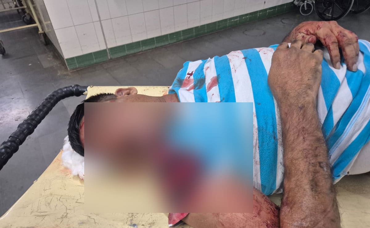 11 9 Two DSPs of Andhra Police killed in road accident