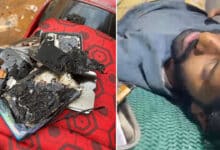 Hyderabad: Vivo Phone Catches Fire in Attapur, Youth Suffers Severe Burns