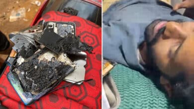 Hyderabad: Vivo Phone Catches Fire in Attapur, Youth Suffers Severe Burns